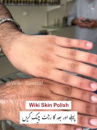 Wiki Special Skin Polish Kit (
